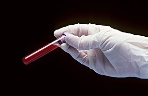 10 khám phá y học quan trọng nhất năm 2011